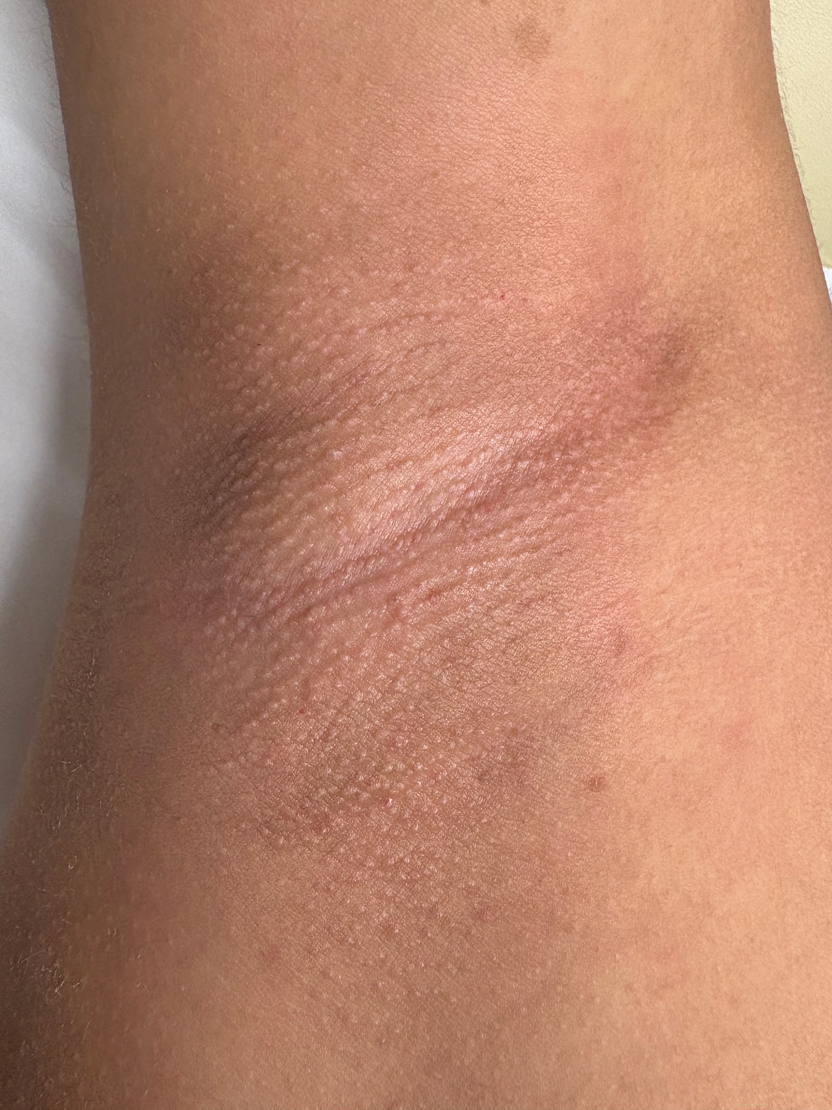 Underarm Wax